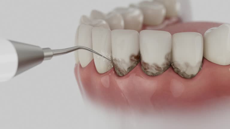 Trusted Teeth Cleaning And Checkup service in Hayti, PA - Dentist Open Now